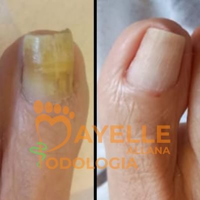 podologia em sumaré podologia em sumaré